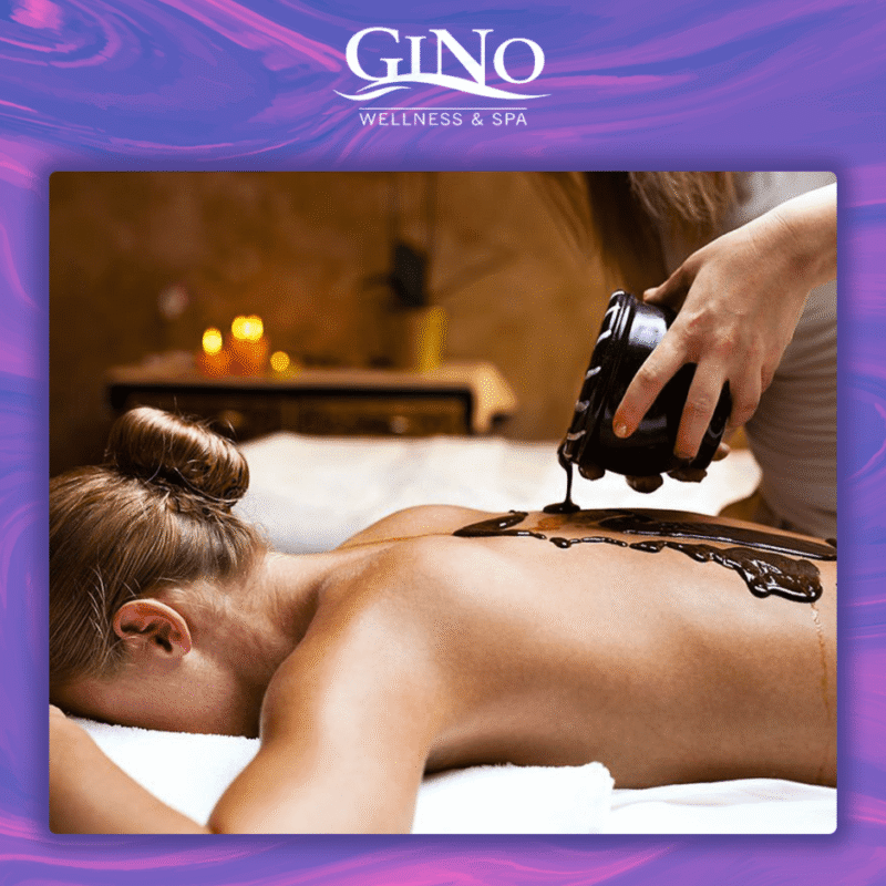 შოკოლადის პროცედურა